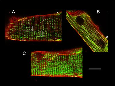 Excitation-contraction coupling in mammalian skeletal muscle: Blending old and last-decade research